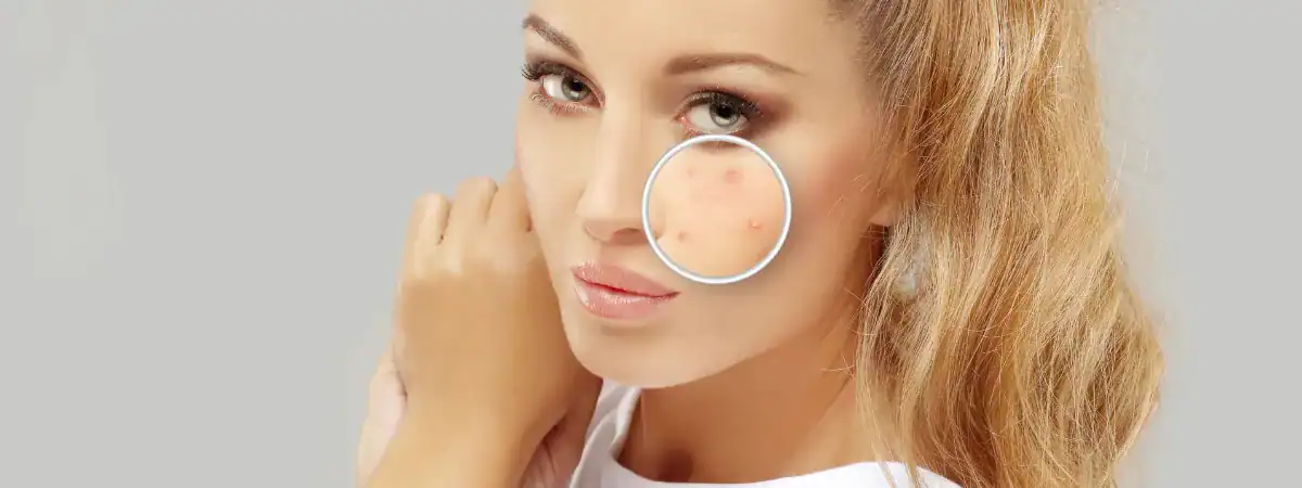 PROJDĚTE SPRÁVNOU DETOXIKACÍ KROK ZA KROKEM